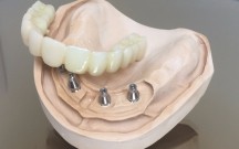  "Dentala Studija" SIA - zobu implanti 2